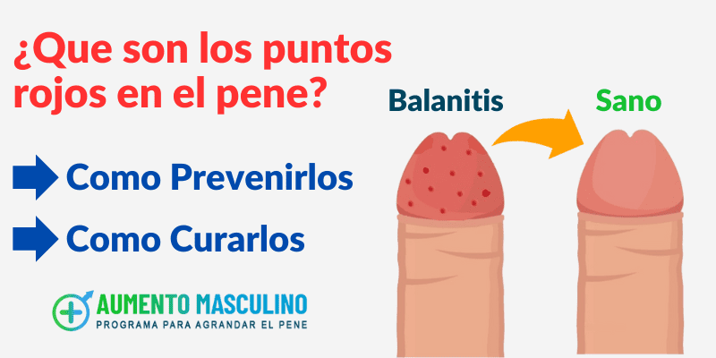 puntos rojos en la cabeza del pene